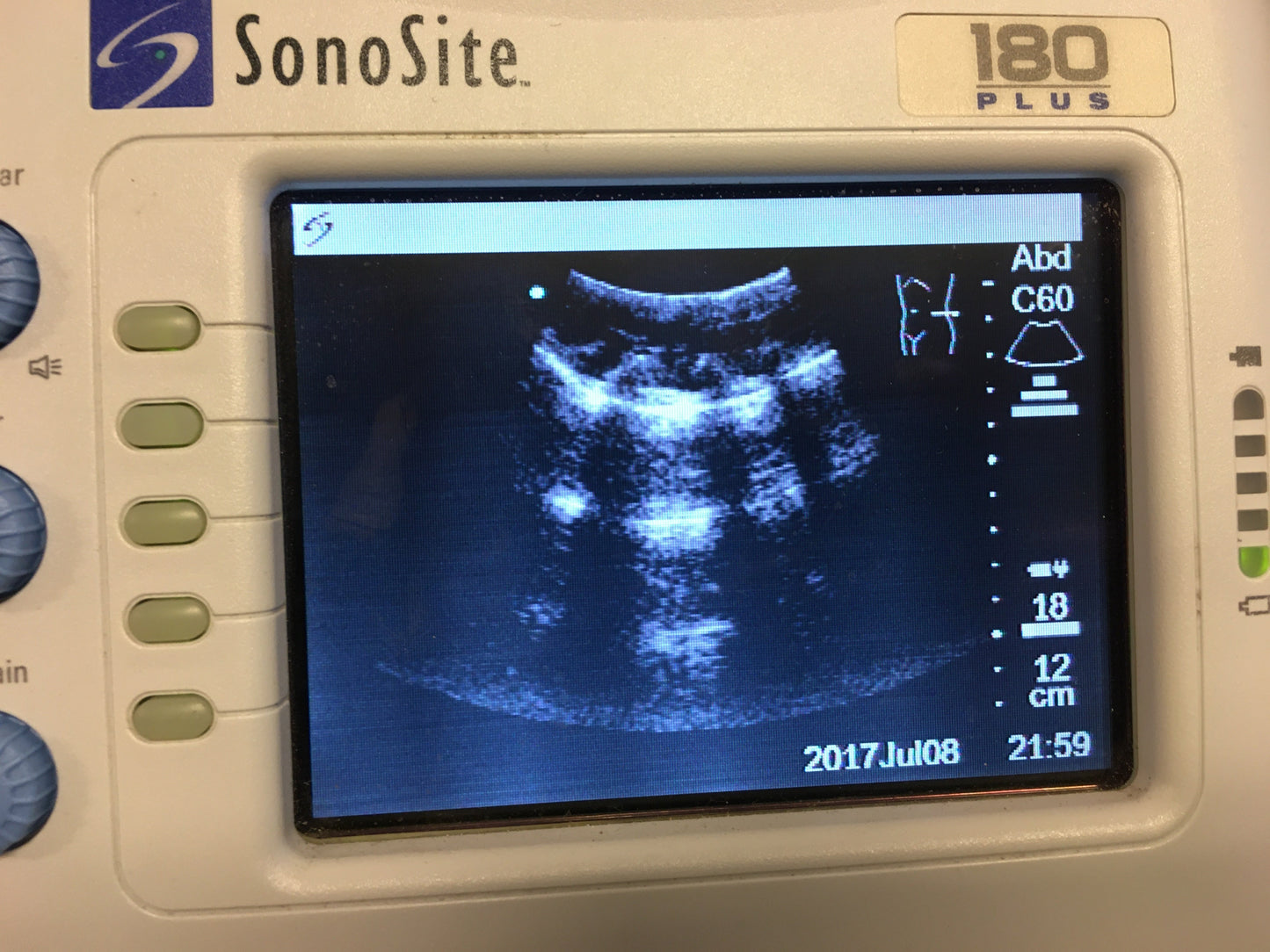 Draagbaar echo apparaat Sonosite 180+ met probe en accu voorheen van Bundeswehr