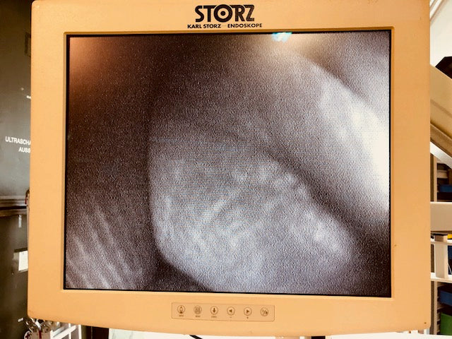 Endoscopietoren Karl Storz met lange flexibele scope 3,25 mtr 60332P (Paard)